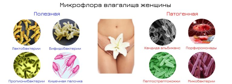 Патогенная микрофлора влагалища - 1-й признак дисбиоза 6 mikroflora vlagalishcha zhenshchiny