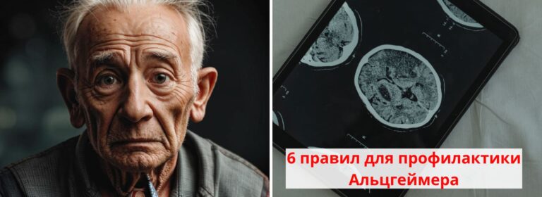 Профилактика Альцгеймера: 7 правил и способов 7 profilaktika alcgejmera 6 pravil i uprazhnenij